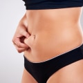 The Truth About Liposuction: Can You Keep the Fat Off?
