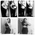 The Truth About Liposuction: How Much Fat Can Really Be Removed?