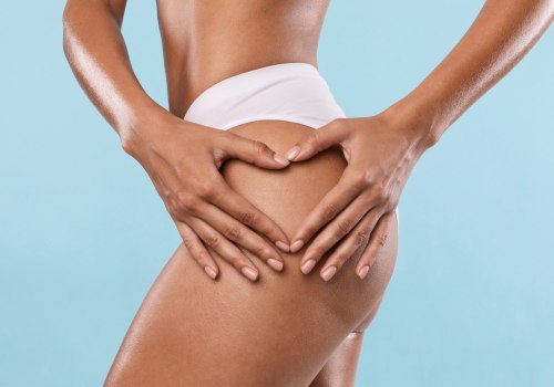 Is Liposuction Right for You?