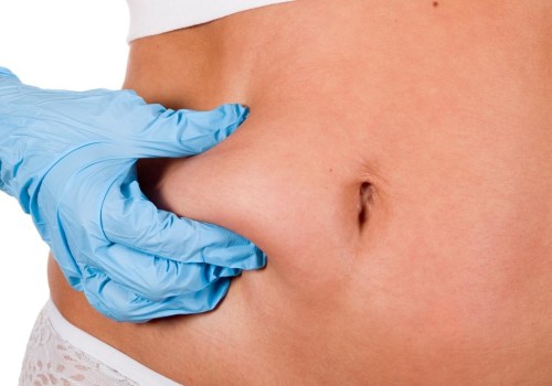 Is Liposuction Safe for All Ages?