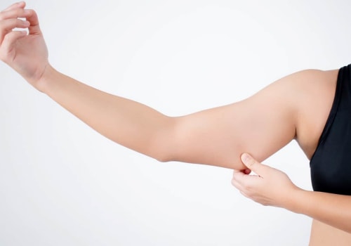 Is Liposuction the Right Choice for You?