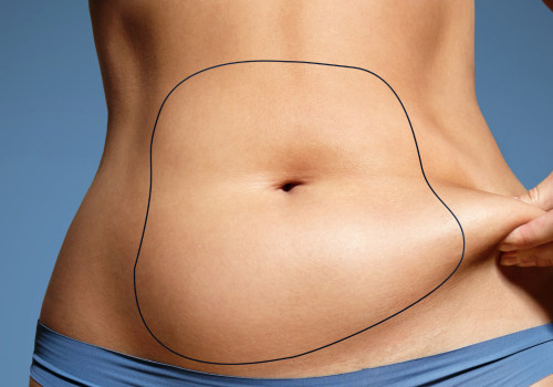 The Truth About Liposuction: Debunking Common Misconceptions