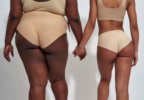What No One Tells You About Liposuction—And Why Dr Q in Glasgow Is Leading the Way