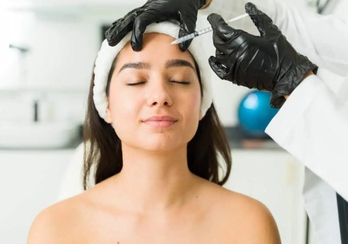 Radiesse Collagen Stimulator: The Science Behind Long-Lasting Facial Rejuvenation